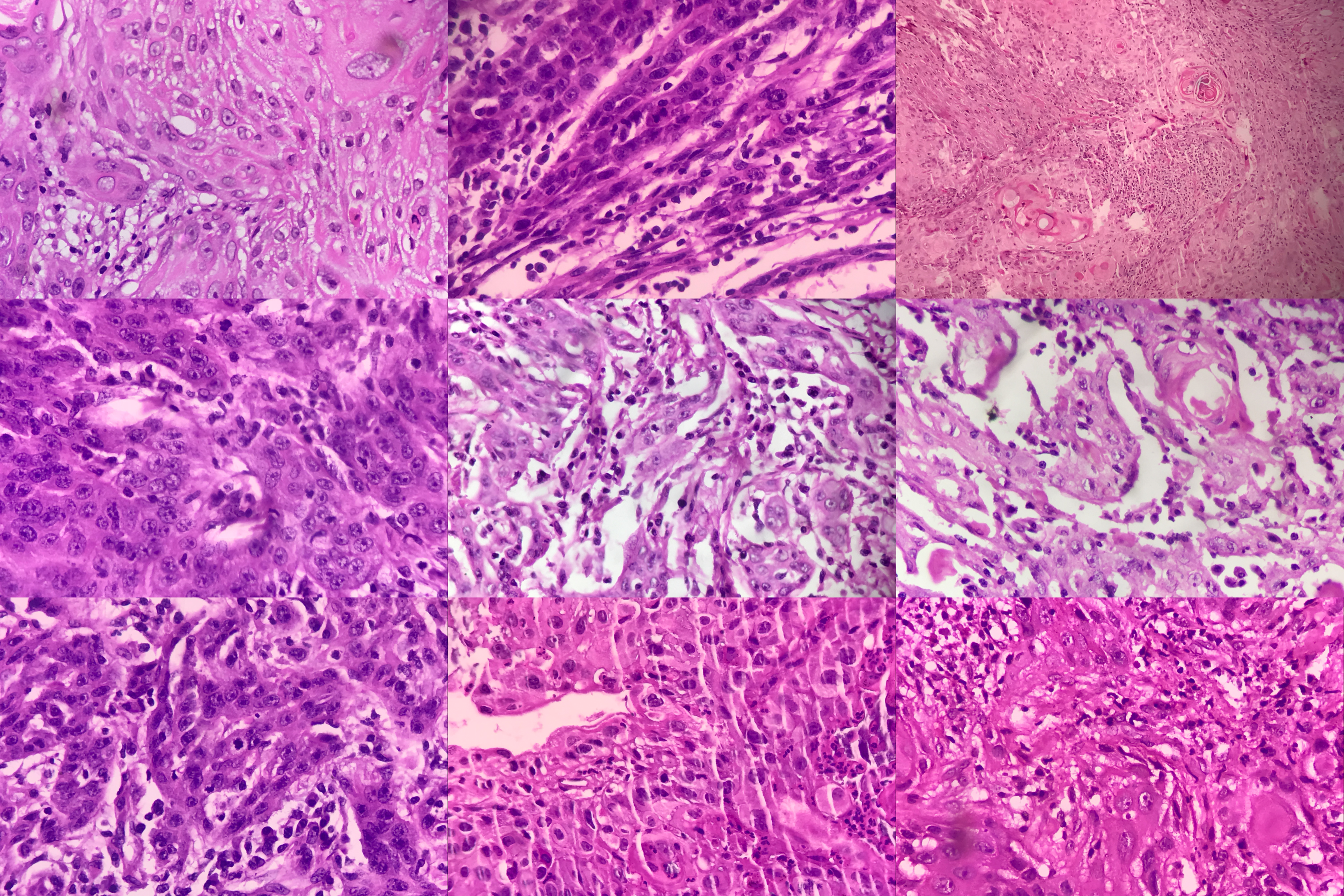 Mitosis Detection